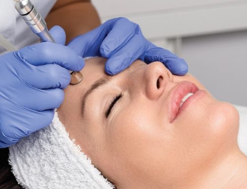 What Are The Benefits of Using PRP with Microneedling?